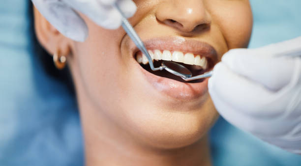 Best Emergency Dental Care for Broken or Chipped Teeth in Hinton, OK