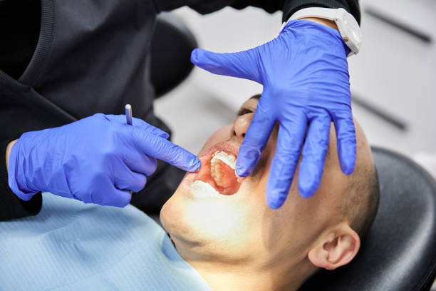 Best Emergency Gum Treatment in Hinton, OK